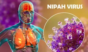 Wabah Penyakit Nipah yang Selalu Jadi Perhatian Dunia