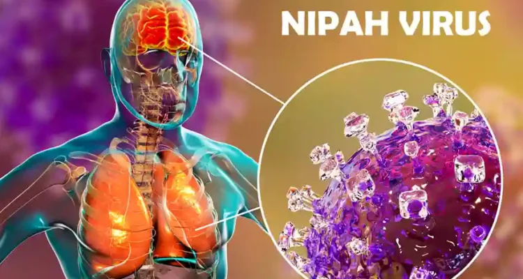 Wabah Penyakit Nipah yang Selalu Jadi Perhatian Dunia