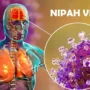 Wabah Penyakit Nipah yang Selalu Jadi Perhatian Dunia