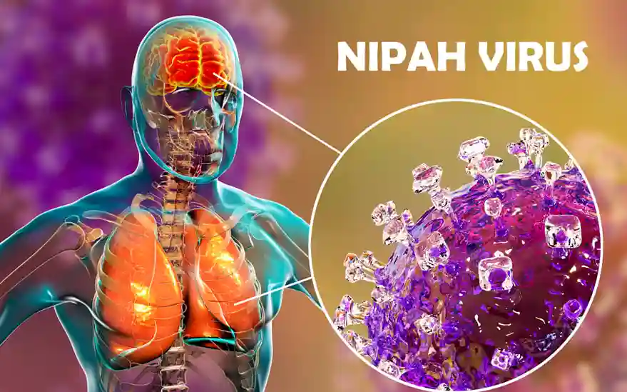 Wabah Penyakit Nipah yang Selalu Jadi Perhatian Dunia